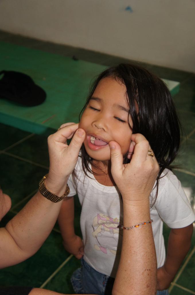 Analie...et les caries